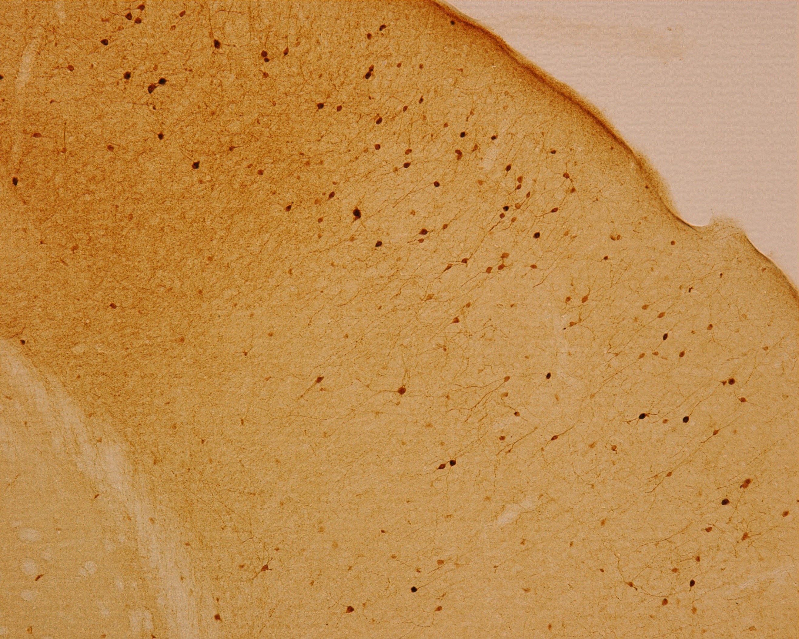 Rabbit monoclonal recombinant anti Calretinin Antibody