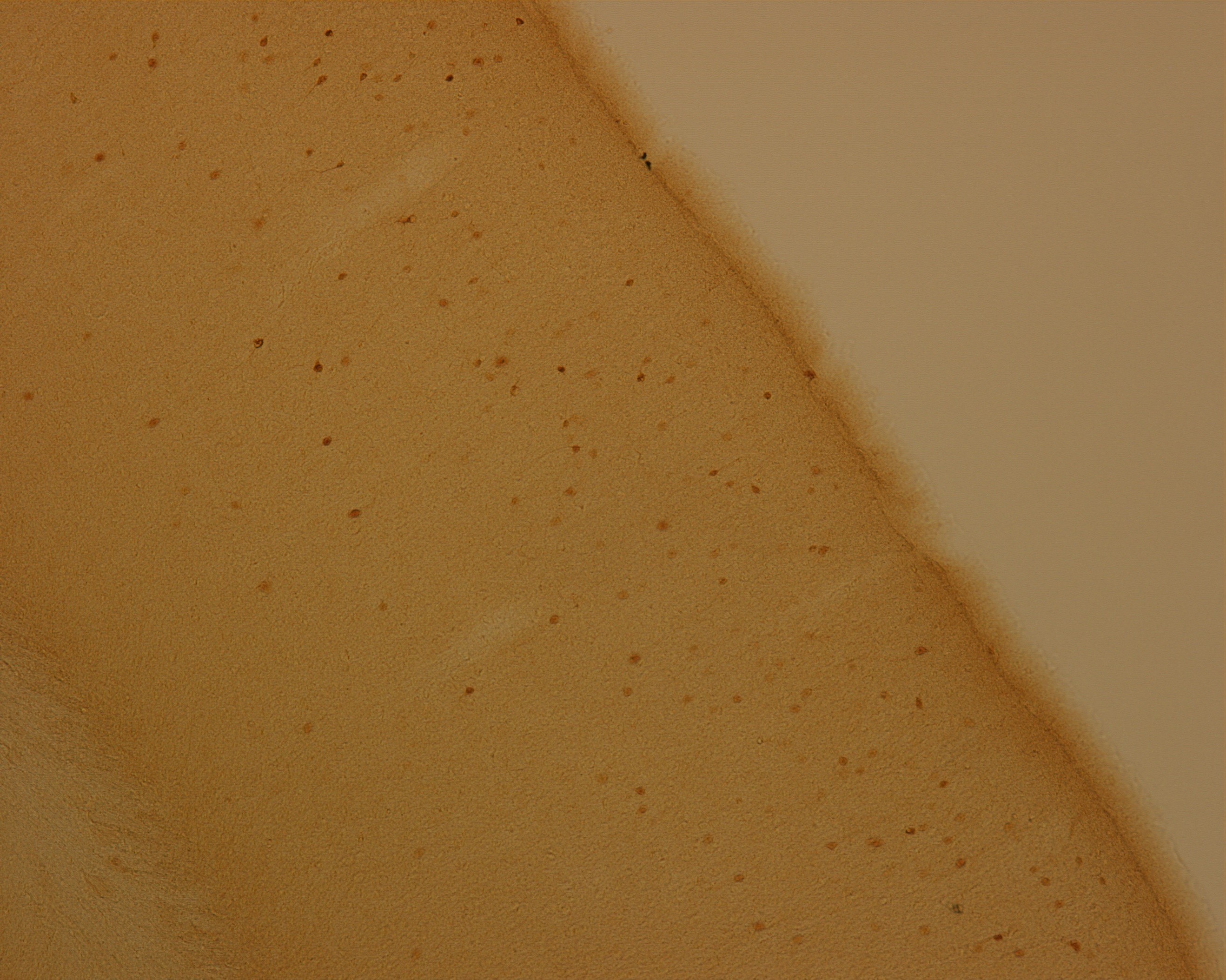 Chicken anti-Calretinin Antibody