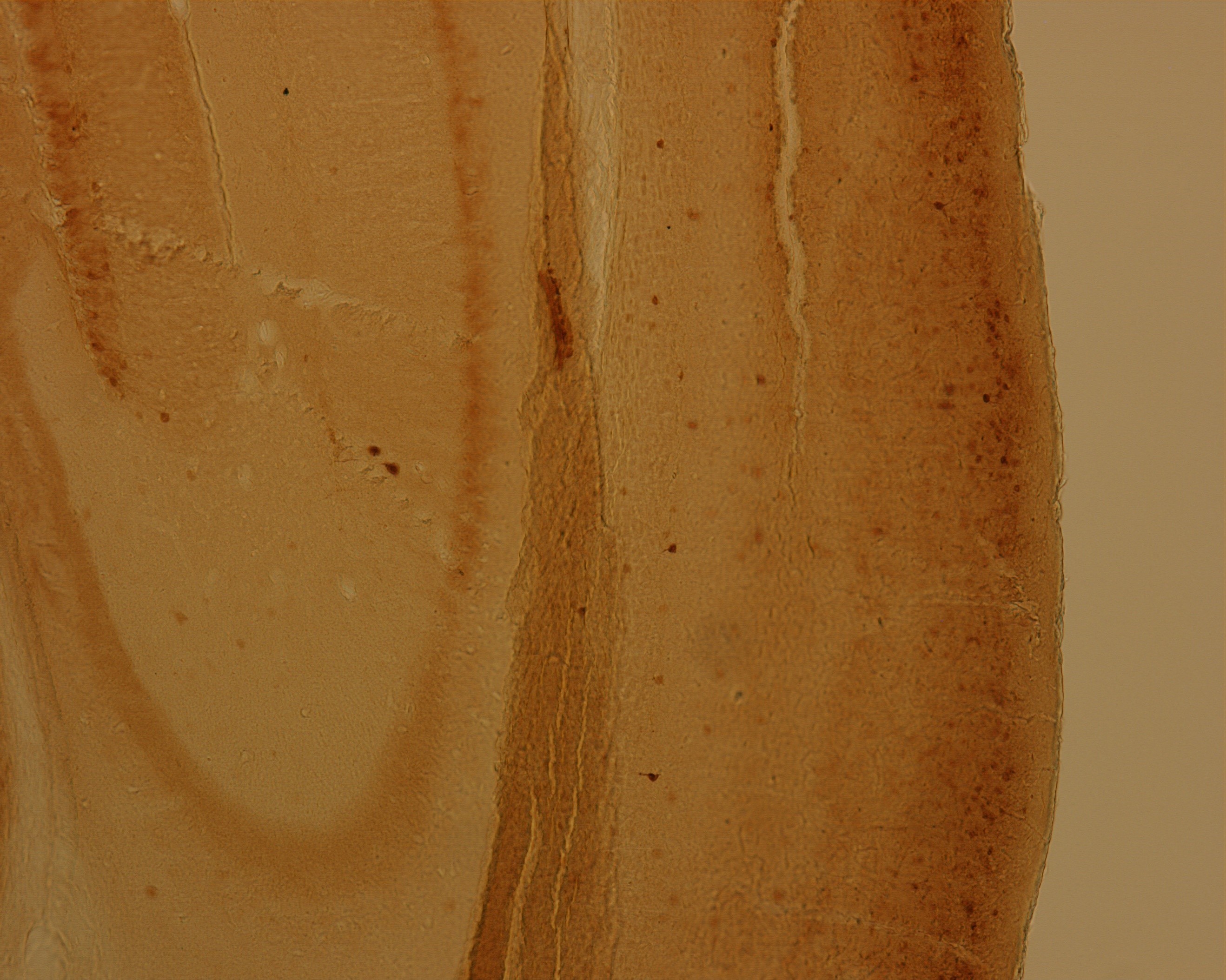 Chicken anti-Calbindin Antibody