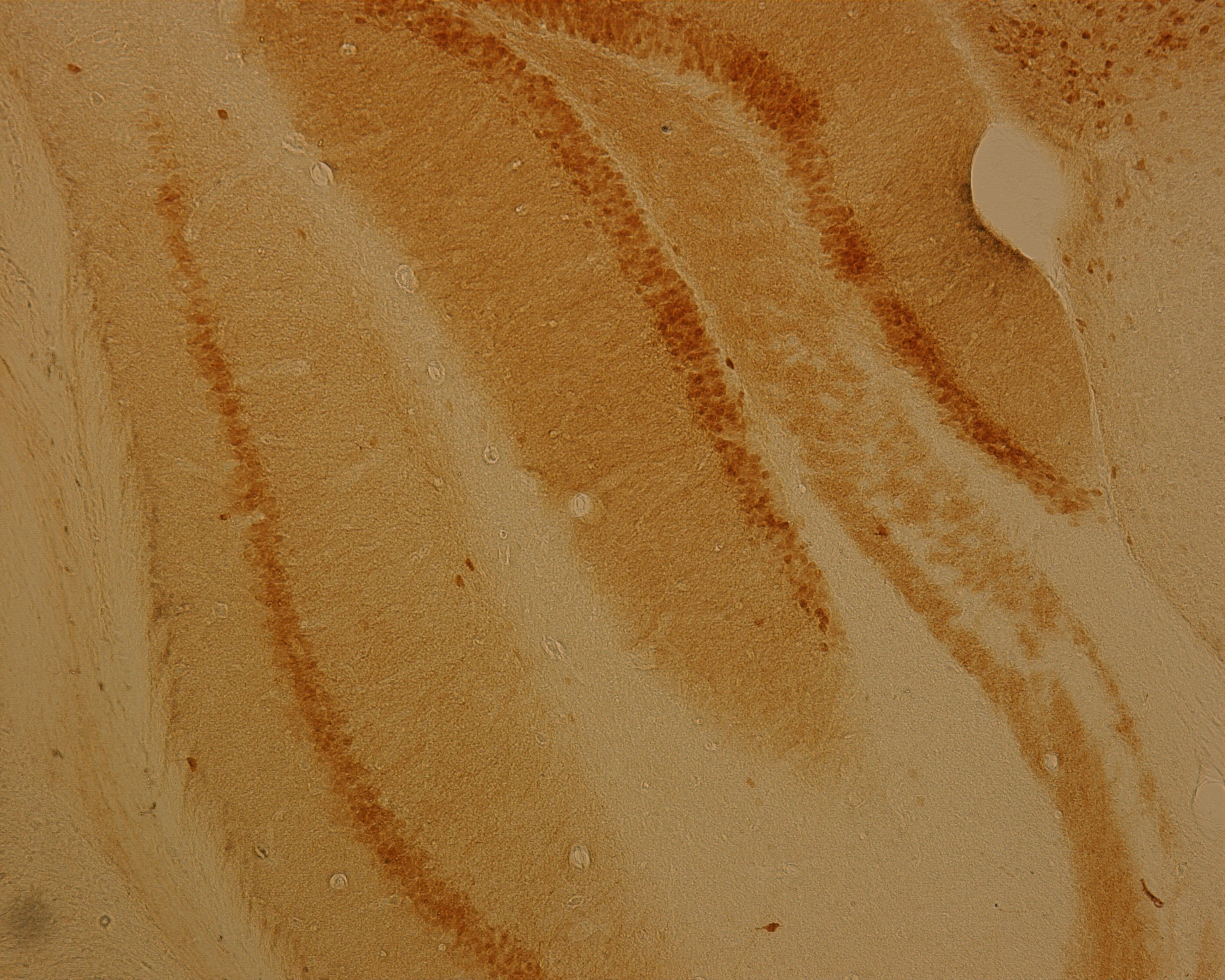 Rabbit monoclonal recombinant anti Calbindin Antibody