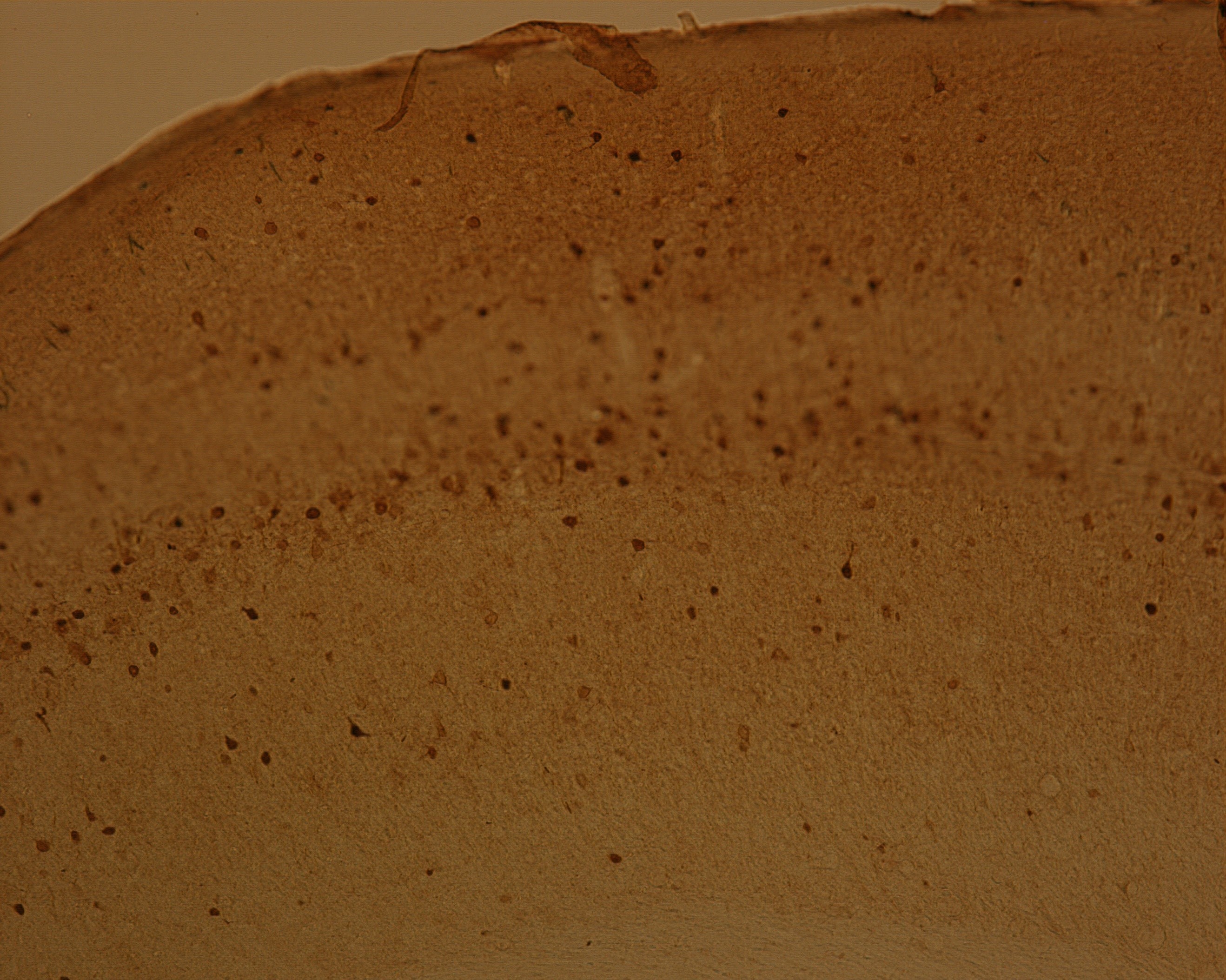 Chicken anti-Parvalbumin Antibody