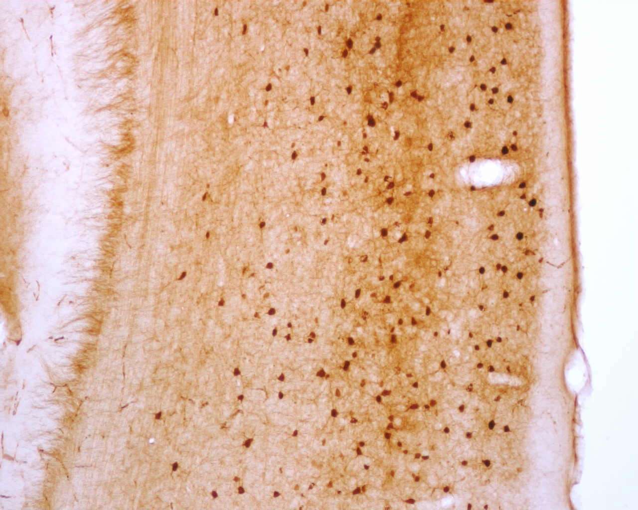 Purified Monoclonal anti-Parvalbumin Antibody