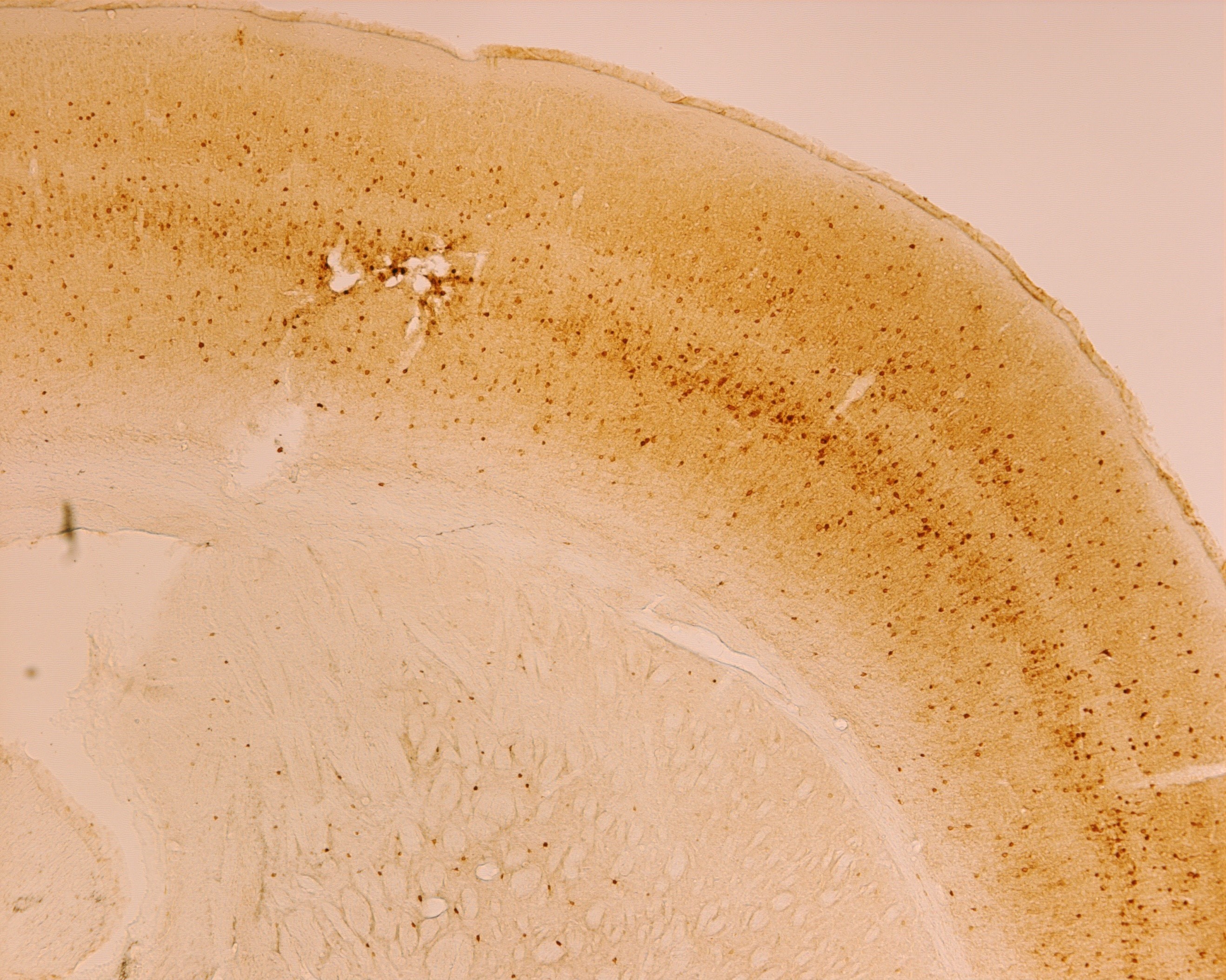 Rabbit monoclonal recombinant anti-Parvalbumin Antibody
