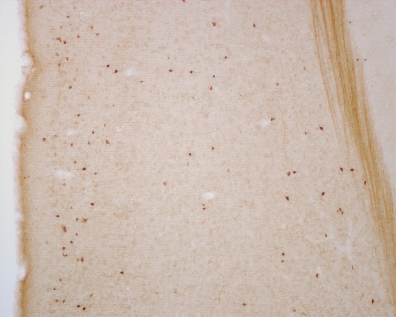 Rabbit anti-Calretinin Antibody